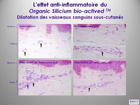 pitié-salpétrière-tests anti-inflammatoire.jpg